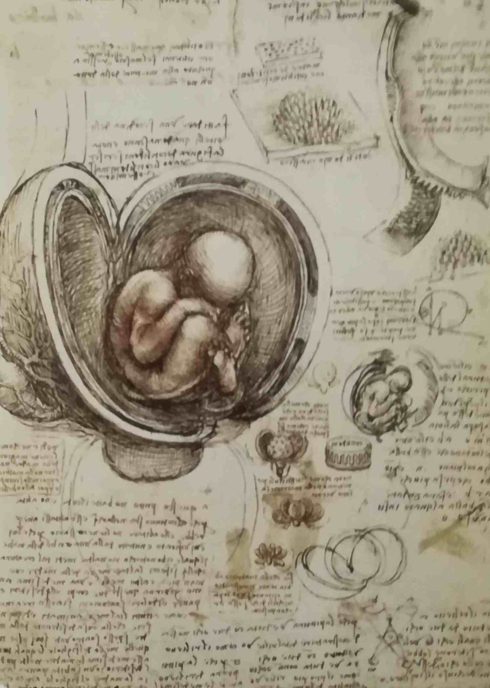 Leonardo da Vinci - sezione di utero gravido, con il feto in stato di avanzato sviluppo