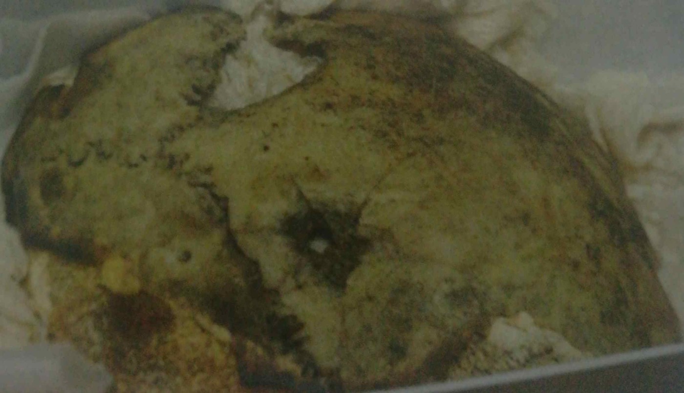frammento della scatola cranica. Sono visibili l’impatto del proiettile, i segni della cremazione e le tracce di terra