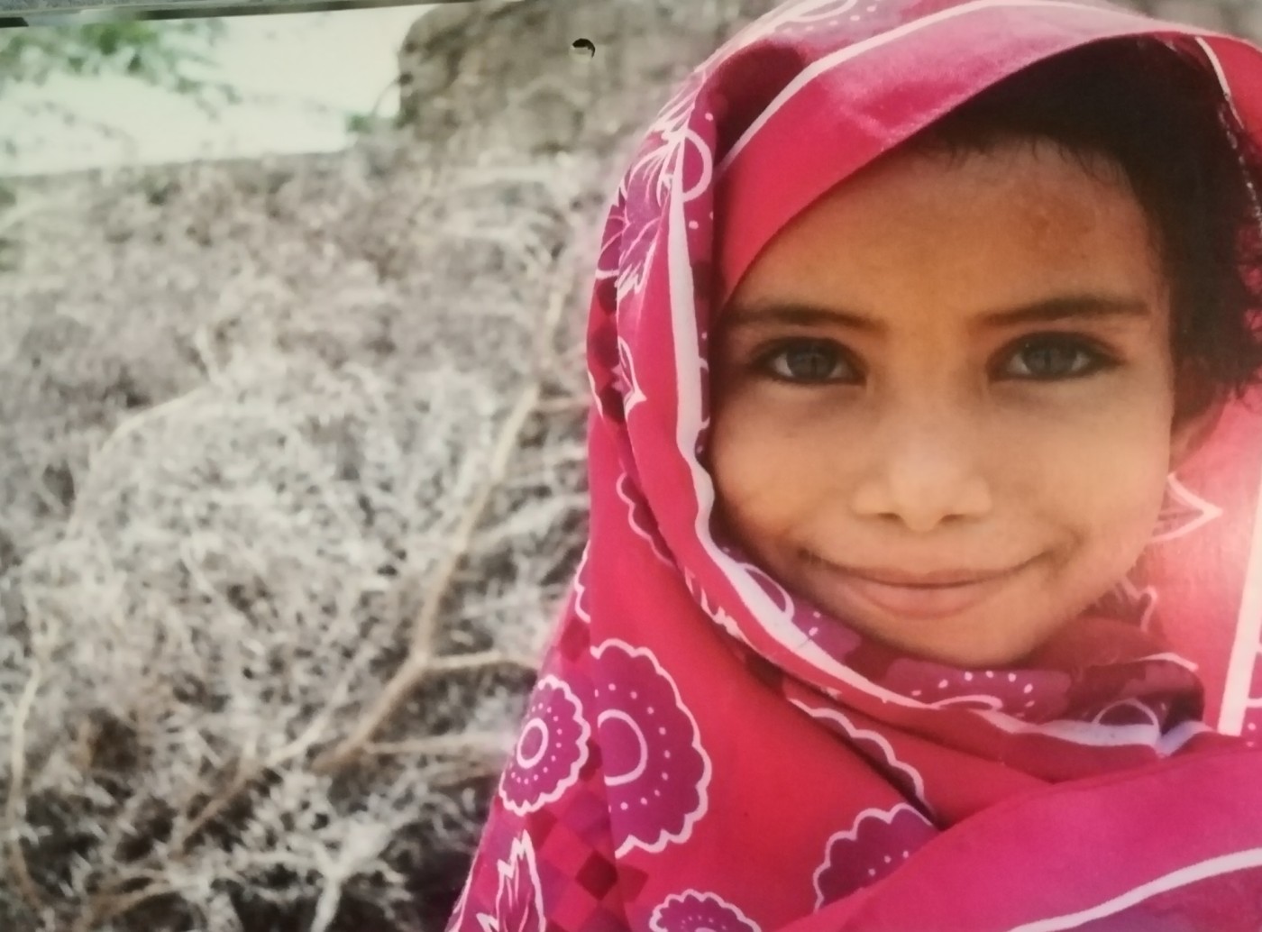 YEMEN Salma, 7 anni, sorride felice perchè è tornata a giocare con la sorellina, guarita dalla malnutrizione