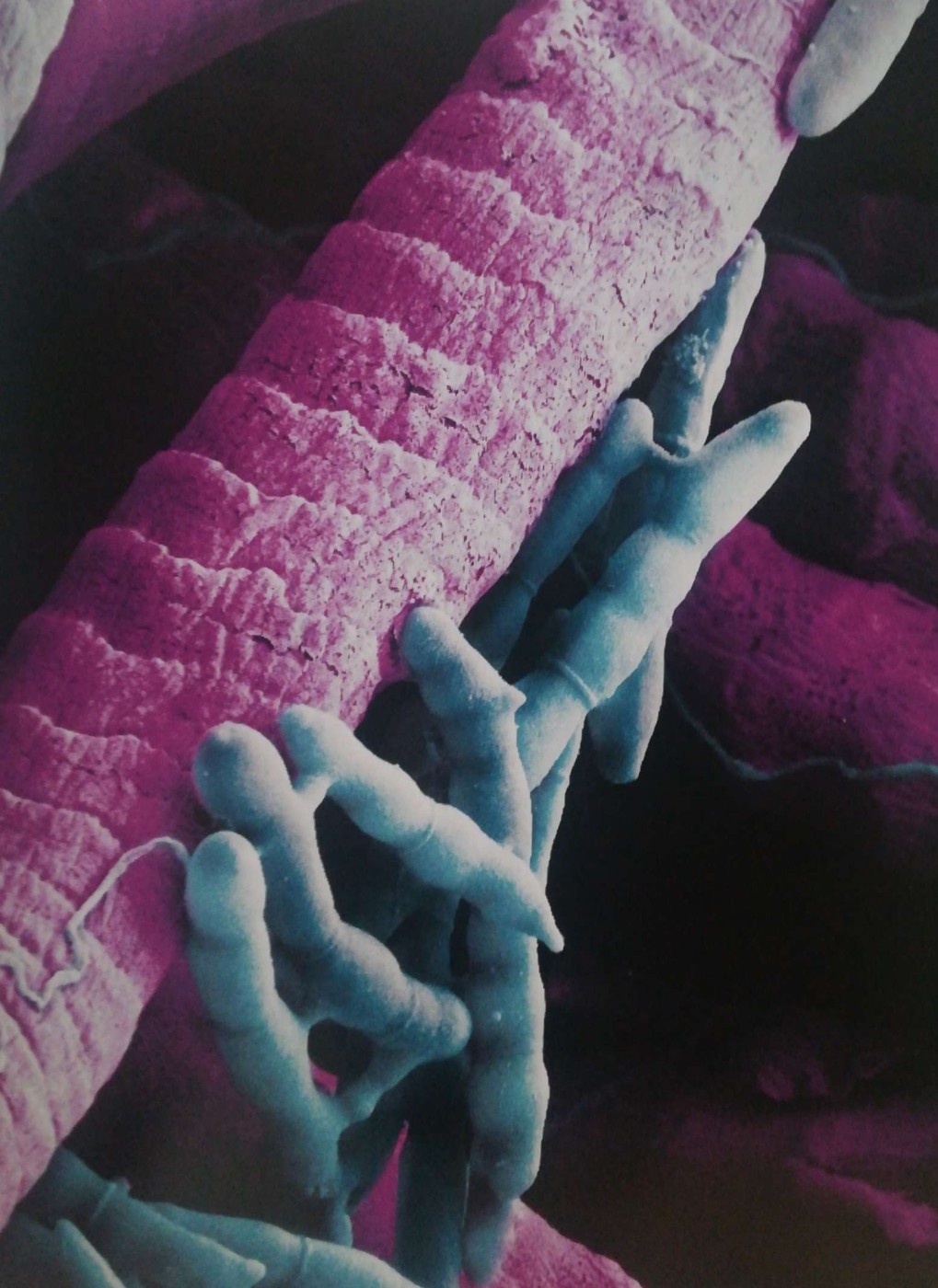fungo Ophiocordyceps (di blu) cresce attorno le fibre muscolari della formica (rosa). Immagine microscopio elettronico