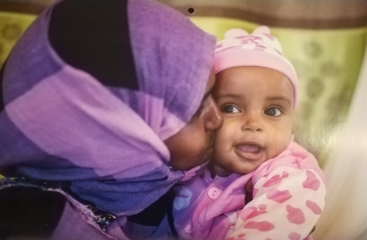 SOMALIA: Hoda, 6 mesi, guarita dalla malnutrizione grazie alle cure ricevute da Save the Children
